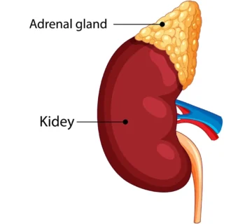 Adrenal Fatigue in Women 360x320